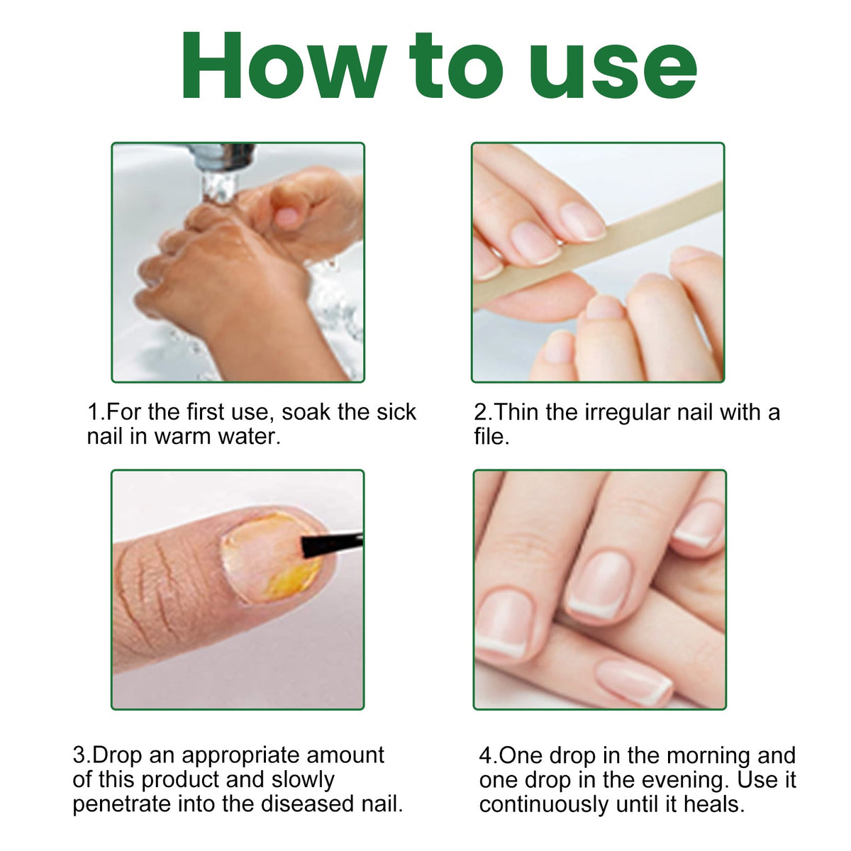 EELHOE Graue Nagel Reparatur Lotion – Effektive Pflege zur Entfernung von Verfärbungen - Si.Kreativkauf