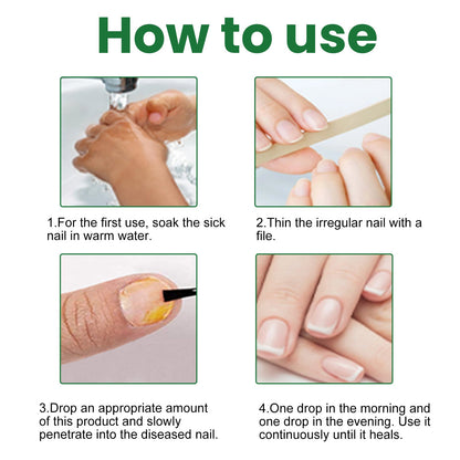 EELHOE Graue Nagel Reparatur Lotion – Effektive Pflege zur Entfernung von Verfärbungen - Si.Kreativkauf