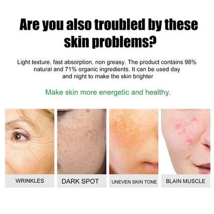 EELHOE Hautpflegecreme für strahlende, feuchtigkeitsspendende Haut und Aknebekämpfung - Si.Kreativkauf