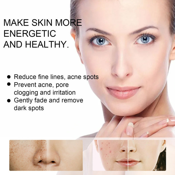 EELHOE Hautpflegecreme für strahlende, feuchtigkeitsspendende Haut und Aknebekämpfung - Si.Kreativkauf