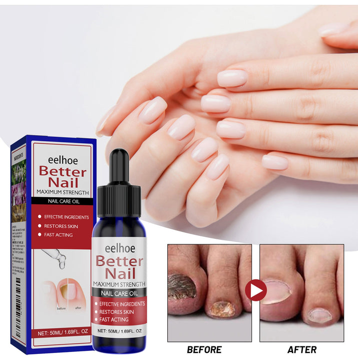 EELHOE Nagelreparaturlösung für gesunde, hydratisierte Hände - Feuchtigkeitsspendende Pflege - Si.Kreativkauf